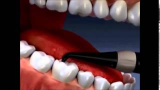 Our tools: Caries Detector screenshot 5