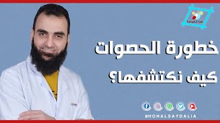 اعراض حصى الكلى .. تعرف عليها واحذر هذه العلامات