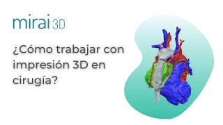 ¿Cómo se utilizan las tecnologías 3D dentro de quirófano? - MIRAI 3D