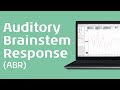 Auditory brainstem response abr an introduction