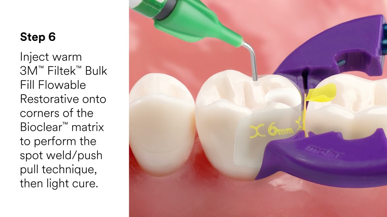 3M™ Filtek™ Dental Restoratives and Bioclear®