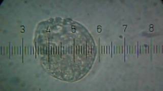 20100626_204650_Protist.avi