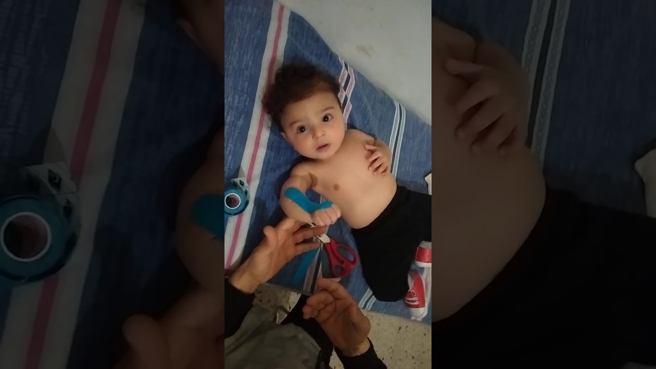 rééducation paralysie obstétricale du plexus brachial