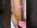 Smooth Underarms Using Sugaring Paste Sugaringhairremoval Sugaring Asmrshorts Asmrcommunity Smooth Underarms Using Sugaring Paste Sugaringhairremoval Sugaring Asmrshorts Asmrcommunity