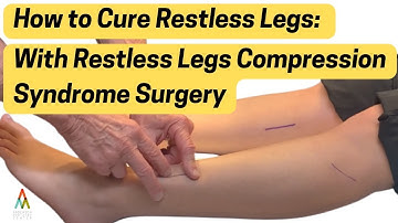 These 3 Nerve Tunnels Are Causing Your Restless Legs: Compression Syndrome Intro