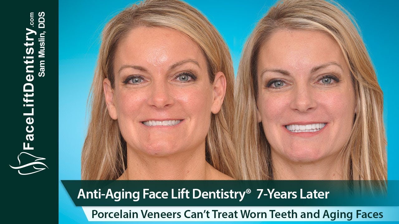 AntiAging Face Lift Dentistry, 7Years Later YouTube