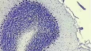 Methods of cell disruption
