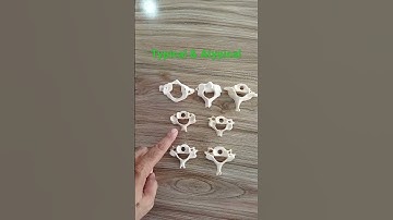 Typical and Atypical Cervical Vertebrae #draqilshah #anatomy #spine #grossanatomy #neckbones #viral