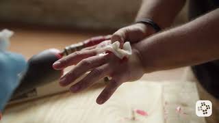 Penetrating Trauma Treatment And First Aid