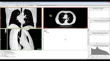Mimics Innovation Suite Introduction - Dicom Image Import and Interface Layout