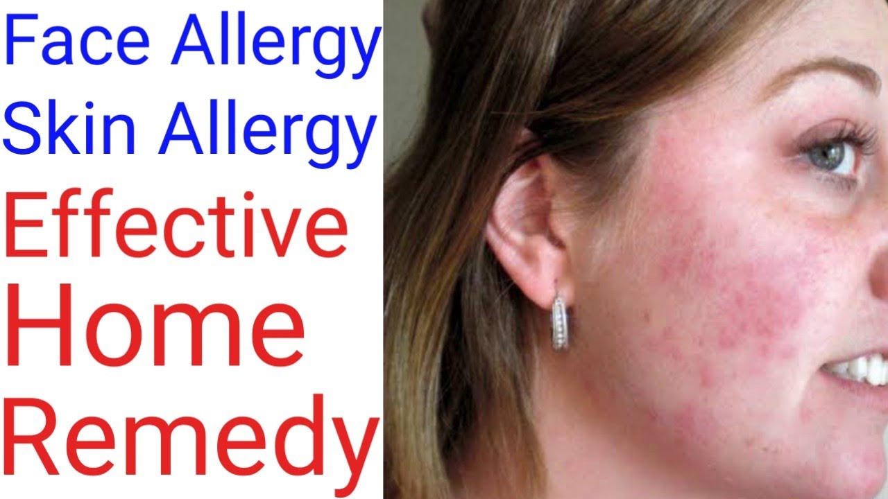 Face ki Allergy ka Ilaj. Skin ki Allergy ka ilaj. Face / Skin Allergy