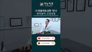 심한 덧니 교정 &#39;한쪽&#39;만 발치한 이유는?