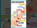 Skin assessment #follow #subscribe #share