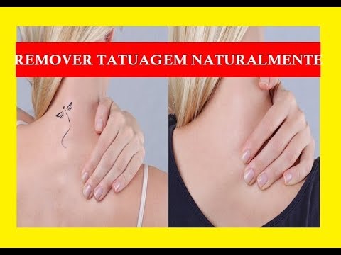 Vídeo: Como Se Livrar De Tatuagens E Microbladings Malsucedidas: Os Principais Métodos E Suas Características