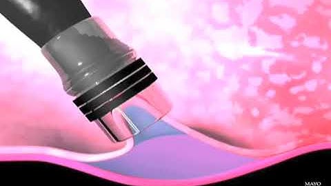 Endoscopische mucosale resectie