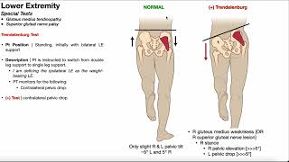 Trendelenburg Test | Rationale &amp; Interpretation