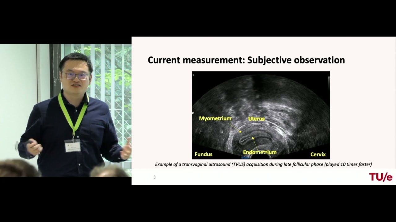 Quantitative ultrasound imaging of uterine peristalsis for prediction of successful fertilization