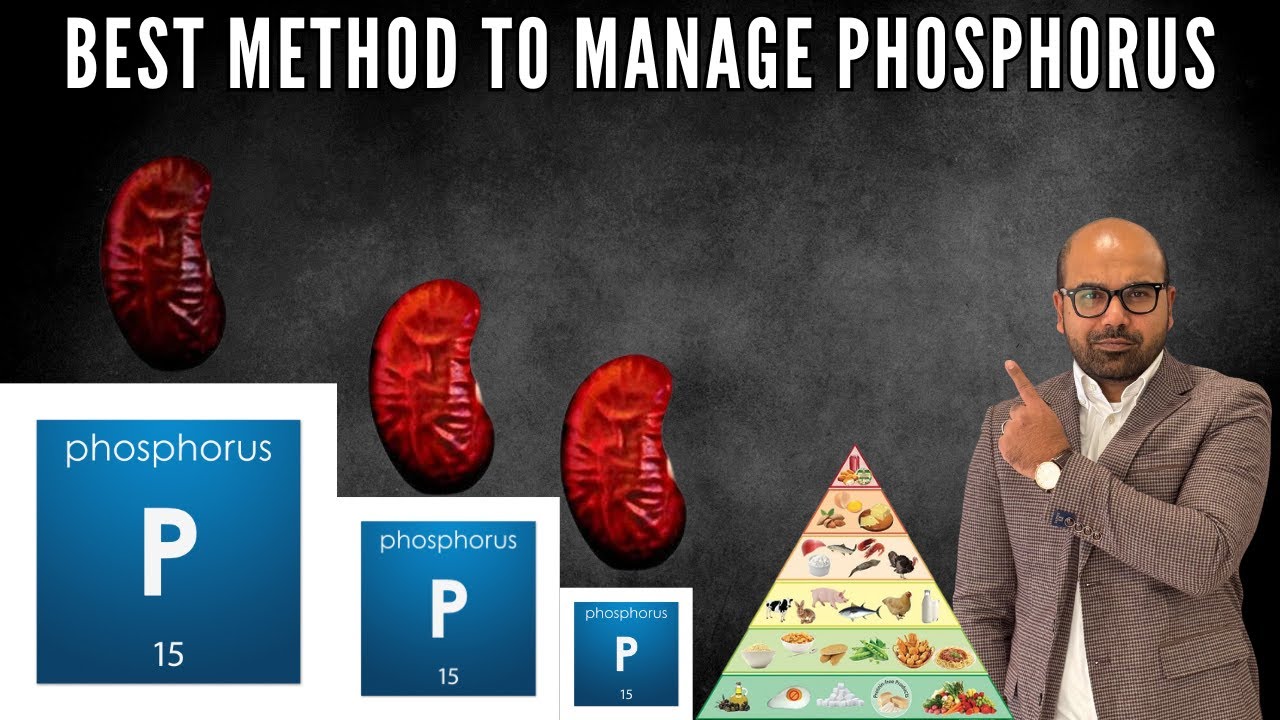 Why Kidney Patients Can't Eat Dates, Nuts & Yogurt? | Episode 289