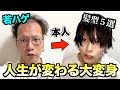 若ハゲが話題の激安ウィッグで人生を変える大変身5選