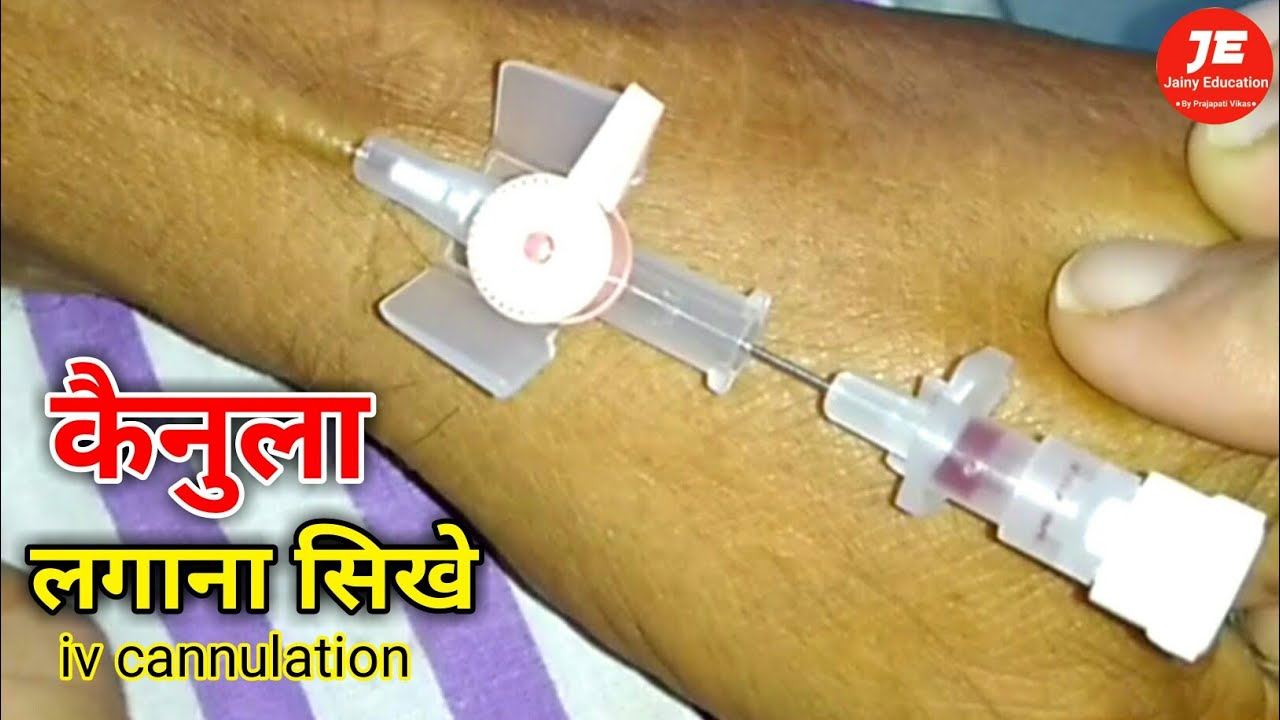 cannula kaise lagate hain Cannula insertion technique kenula kaise