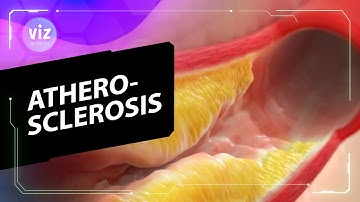 De stille dreiging in je aderen