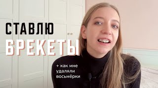 картинка: VLOG Ставлю брекеты | История моих зубов, удаление восьмёрок