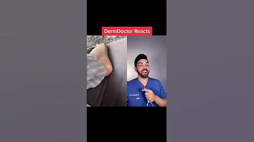 Doctor Reacts to Foot Blister 🦶 #shorts
