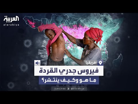 بعد تصنيفه حالة طواررئ عالمية خطورة جدري القردة وطرق انتشاره
