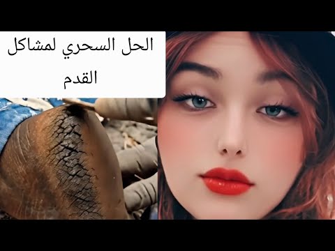 جواريب السليكون وجواريب الجل سحر للقدم طريقة استخدامهم وفوائدهم واتساب 07740646449 