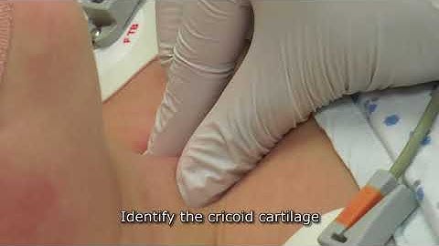 Paediatric Anaesthetics: Chapter 3 - Cricoid pressure