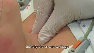 Paediatric Anaesthetics: Chapter 3 - Cricoid pressure