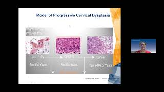 Understanding Your Cervical Health Net Worth