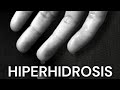 Tratamiento contra la Sudoración excesiva o Hiperhidrosis