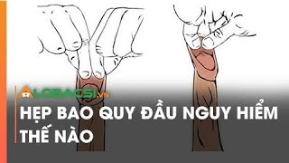 Hẹp Bao Quy Đầu Nguy Hiểm Thế Nào?