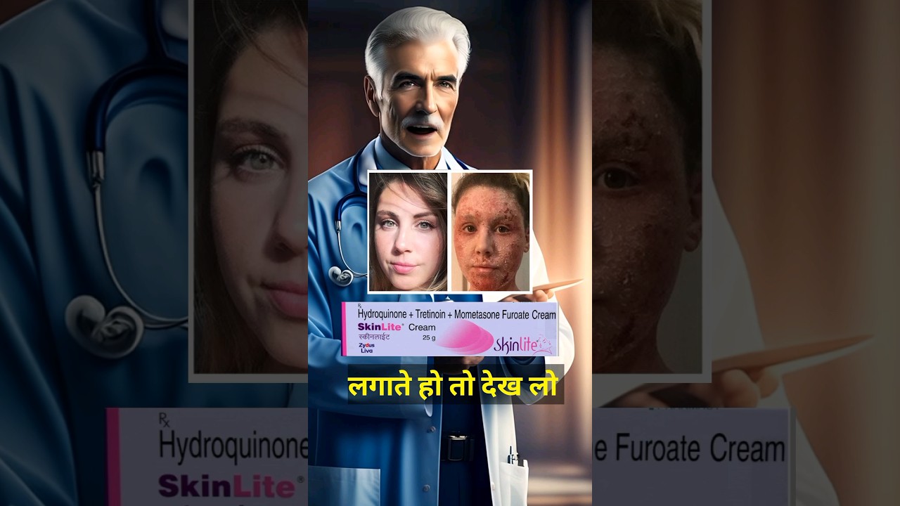 skin light cream,skin light cream side effects,skin light cream review