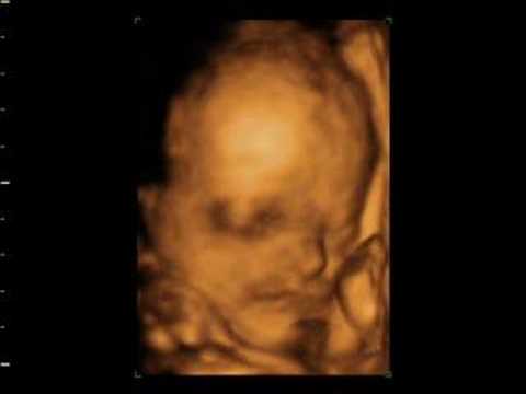 wombo combo alex and jason 4d baby scan