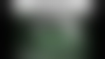 Robotic right upper lobe (S2) posterior segmentectomy