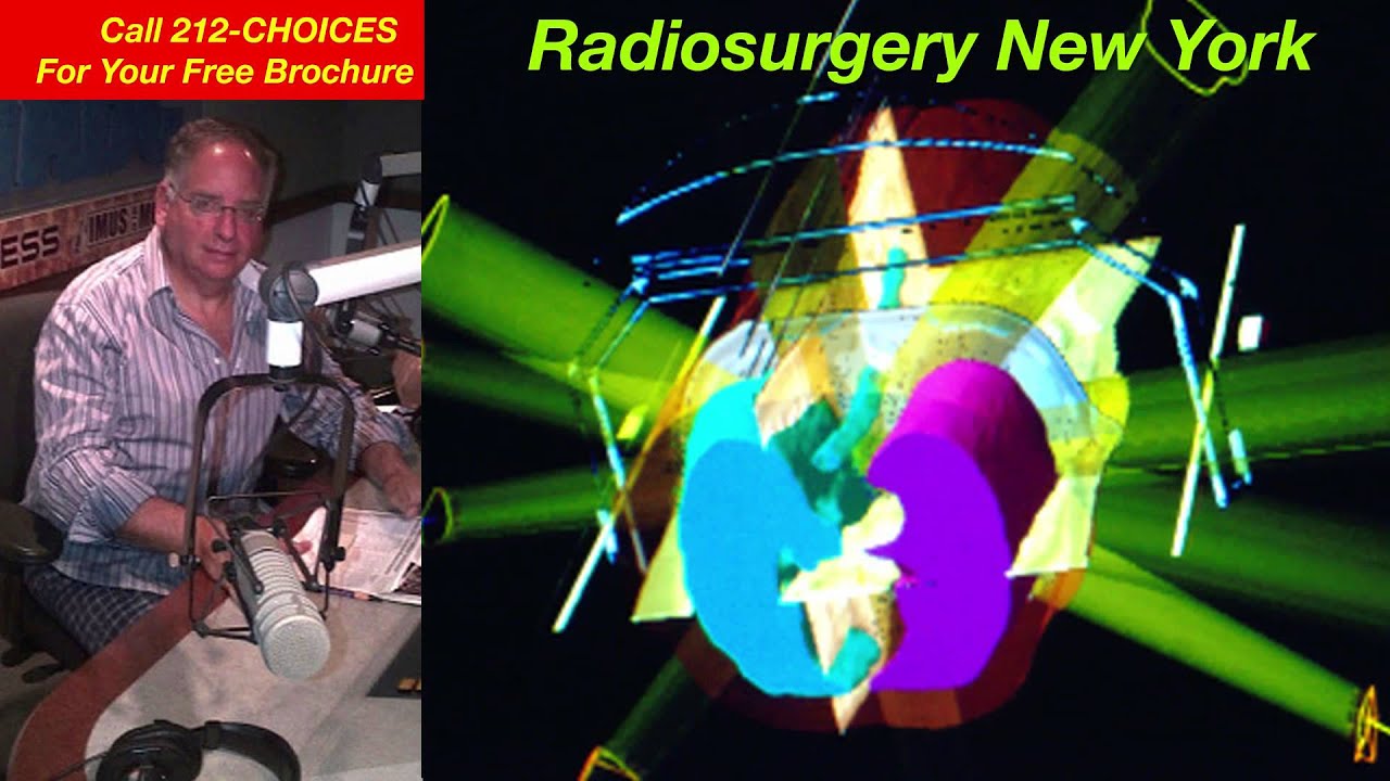 Dr. Gil Lederman's Radiosurgery Show! Podcast 40 Part THREE YouTube
