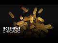 2025 saw increase in whooping cough cases | Health Watch