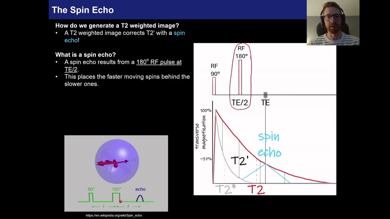 MRI Physics Part 2.3, The Spin Echo