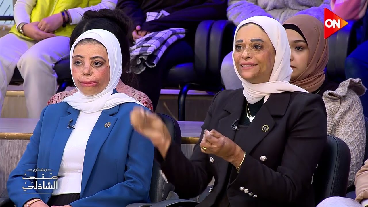 لتفادي الحروق في المطبخ - نصائح مهمة لكل ست