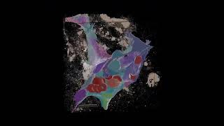 Volume 3D Electron Microscopy of Nanoparticles in Tumour Blood Vessel. Mladjenovic et al. PNAS 2025