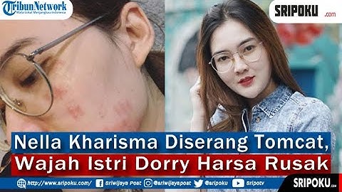 Lagi Hamil Besar, Nella Kharisma Diserang Tomcat, Wajah Istri Dorry Harsa Rusak, Penuh Bercak Merah
