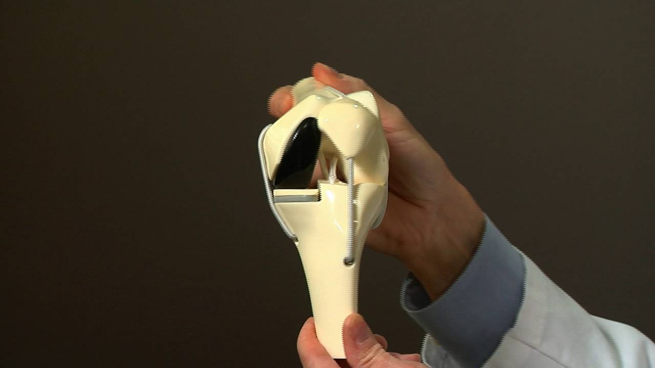 Knee Replacement Surgery | The University of Vermont Health Network