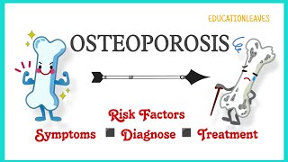 Osteoporosis: Risk Factors, Symptoms, Diagnose, & Treatment