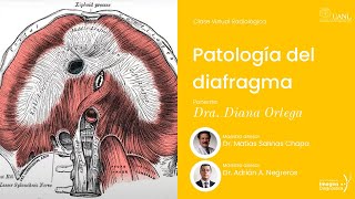 Patología del diafragma por la Dra. Diana Ortega