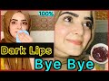 How To Get A Pink Lips Naturally | Remove Pigmentation of Lips |100% Results | Dietitian Aqsa