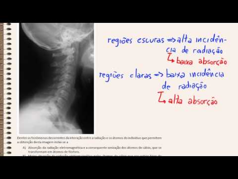 Vídeo: Outro Experimento Foi Conduzido Para Compreender O Fenômeno Das Visões Mortas - Visão Alternativa