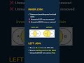 Most Confusing SQL Interview Question | INNER vs LEFT JOIN #shorts #sql #innerjoin #leftjoin
