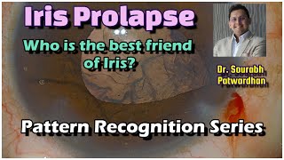 317 Iris Prolapse: Pattern recognition- who is the best friend of Iris Dr Sourabh Patwardhan
